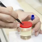 Результат анализа мочи